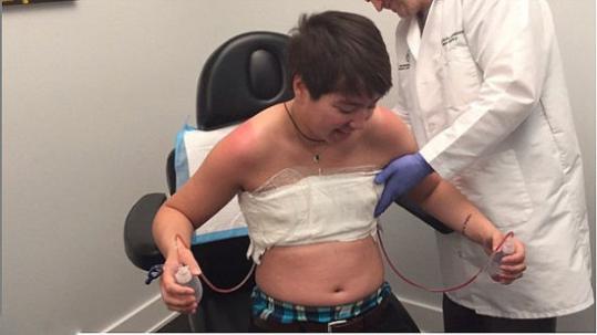 哈佛19岁游泳运动员割乳变性 大方晒手术疤痕