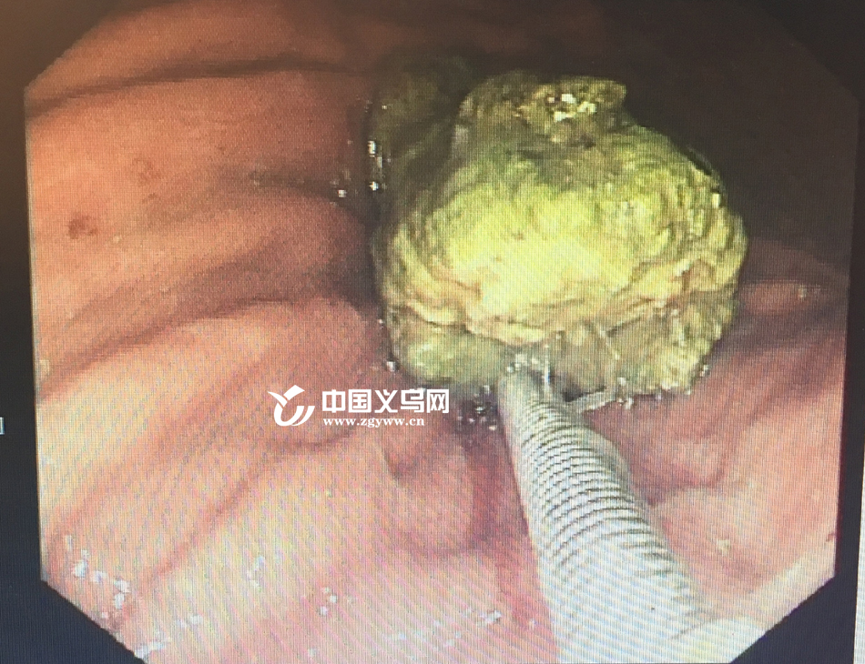 ������Ů��ÿ�λؼҶ��������ʳ ����º󣬸��׵�θ���ˡ���